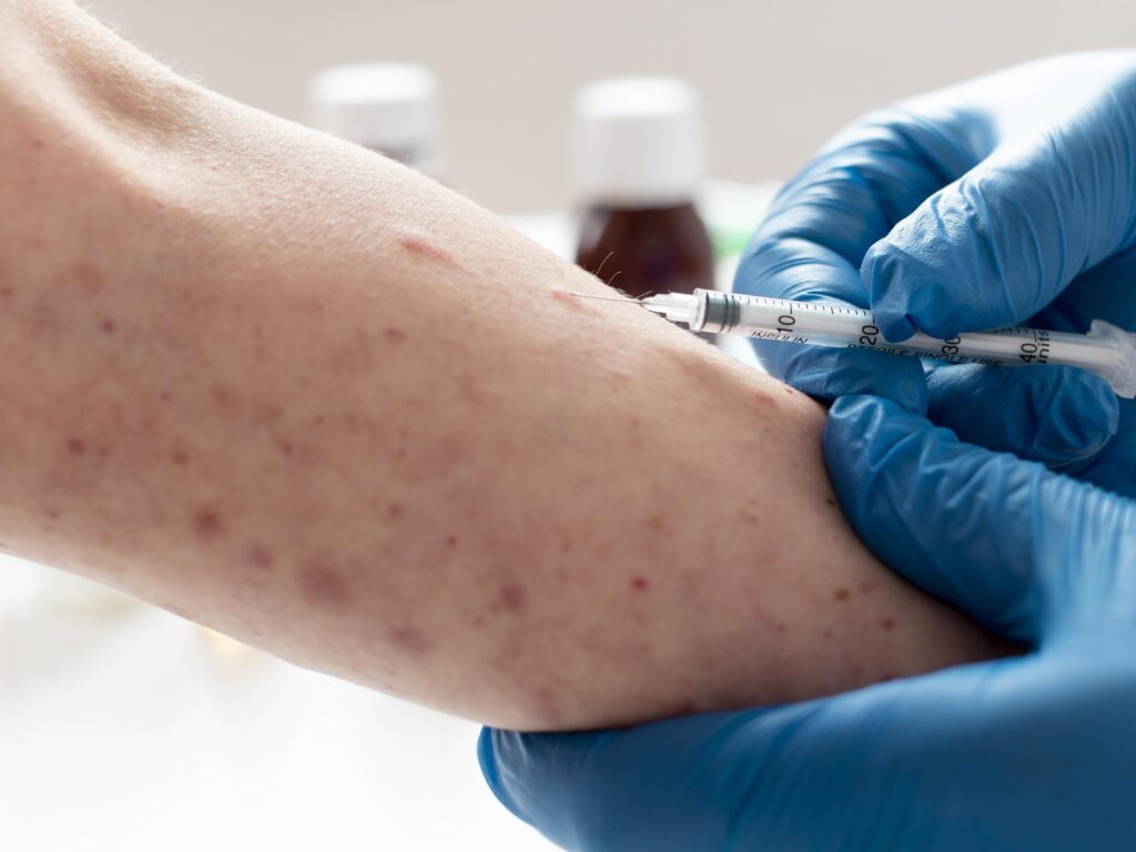 Waspada Campak Jelang Libur Lebaran, Kemenkes Percepat Imunisasi Anak di Wilayah Risiko