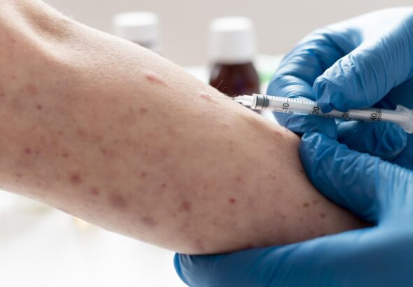 Waspada Campak Jelang Libur Lebaran, Kemenkes Percepat Imunisasi Anak di Wilayah Risiko